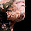 Out of Kit Burn (Small) Prosthetic Appliances   